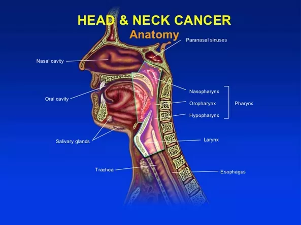 درمان تومور سر و گردن